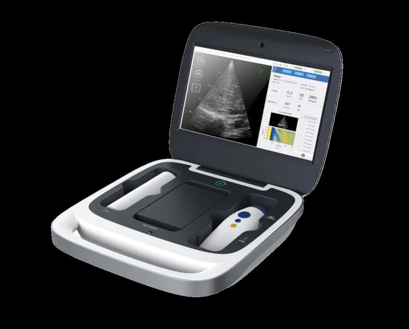 Liverscan C portable elastography workstation